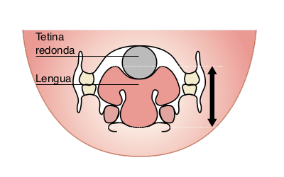 Tetina convencional