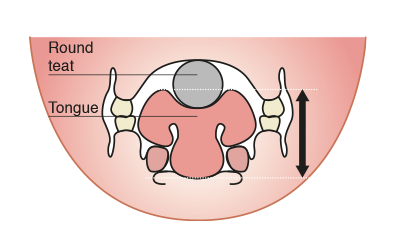 Conventional teat