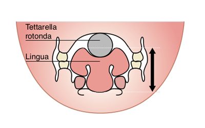 Tettarella Convenzionale