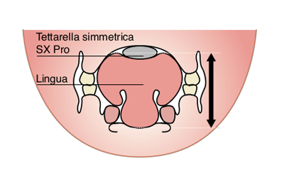 Tettarella Simmetrica SX Pro