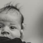 microcefalia bebes