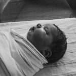 hipoxia fetal