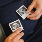 Qué es la bradicardia fetal