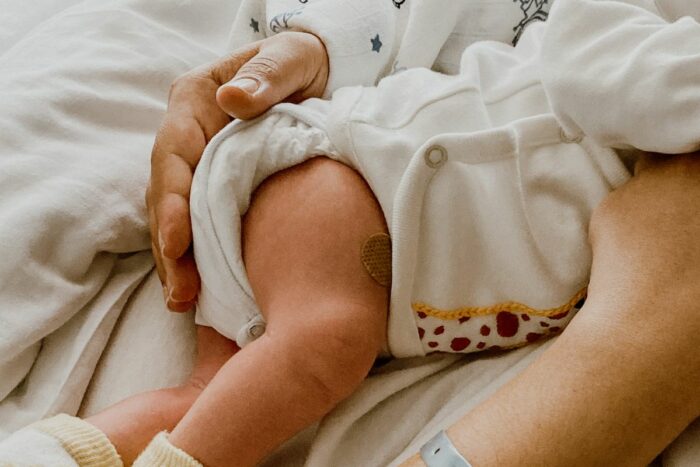 Hipotonía e hipertonía en bebés, ¿Qué es?